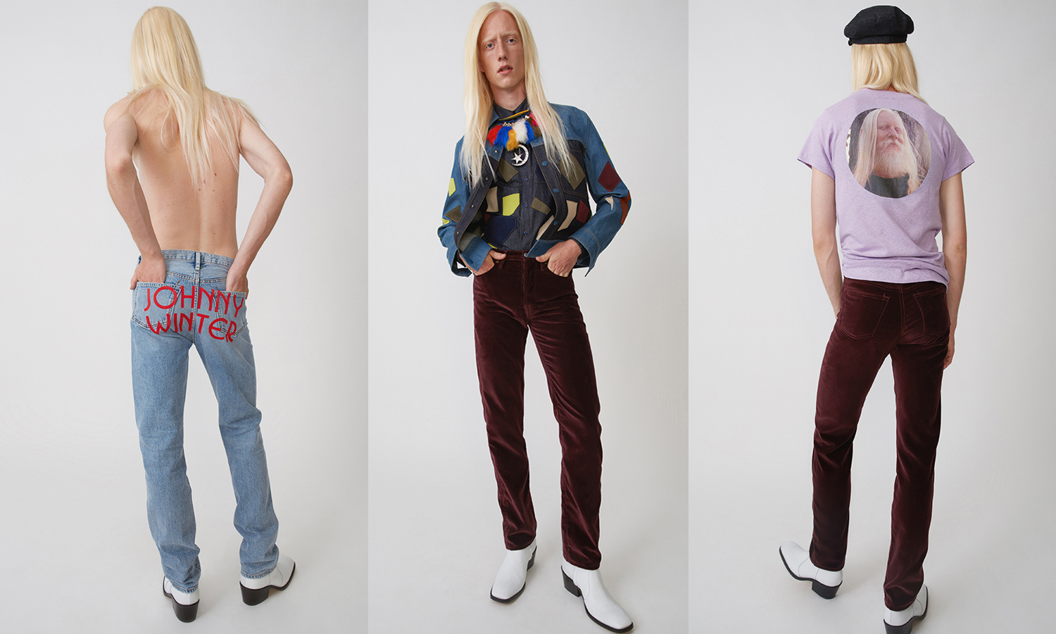 1540314221696-acne.jpeg?