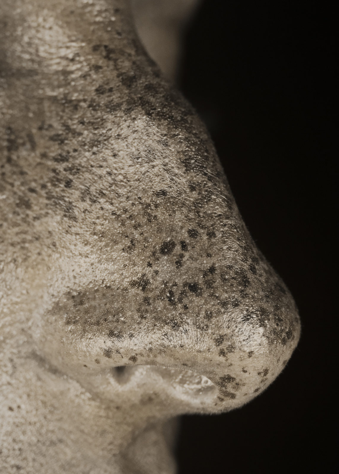 1561479146761-brut_raw_serie_photography_photographie_ultraviolet_UV_portrait_modele_taches_rousseur_freckles_pierre-louis_ferrer_HD_7-1143x1600