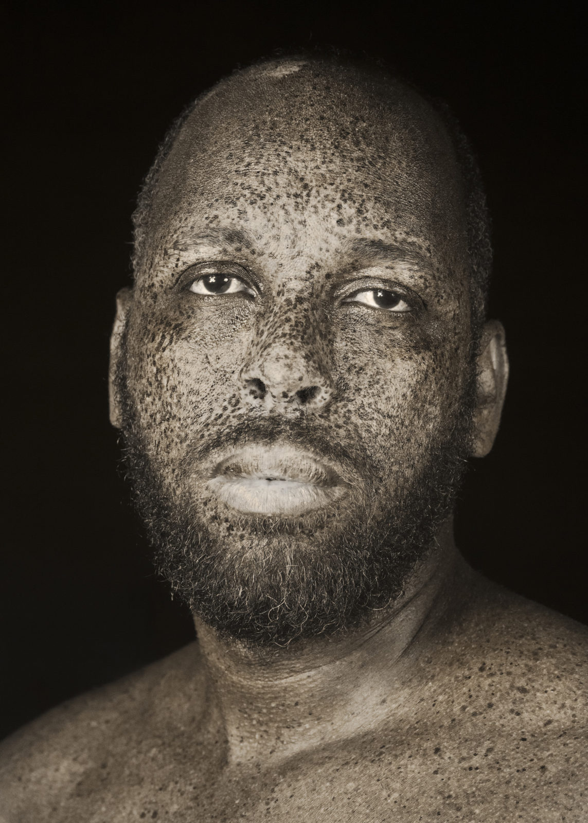 1561479162817-brut_raw_serie_photography_photographie_ultraviolet_UV_portrait_modele_taches_rousseur_freckles_pierre-louis_ferrer_HD_14-1143x1600