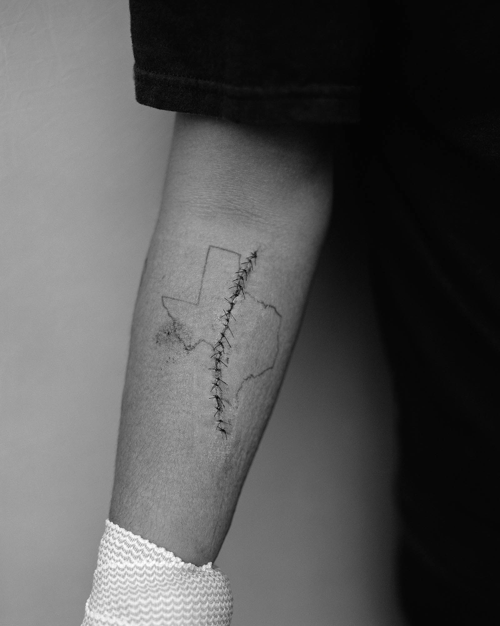 a tattoo of texas with stitches from a cut running through the middle