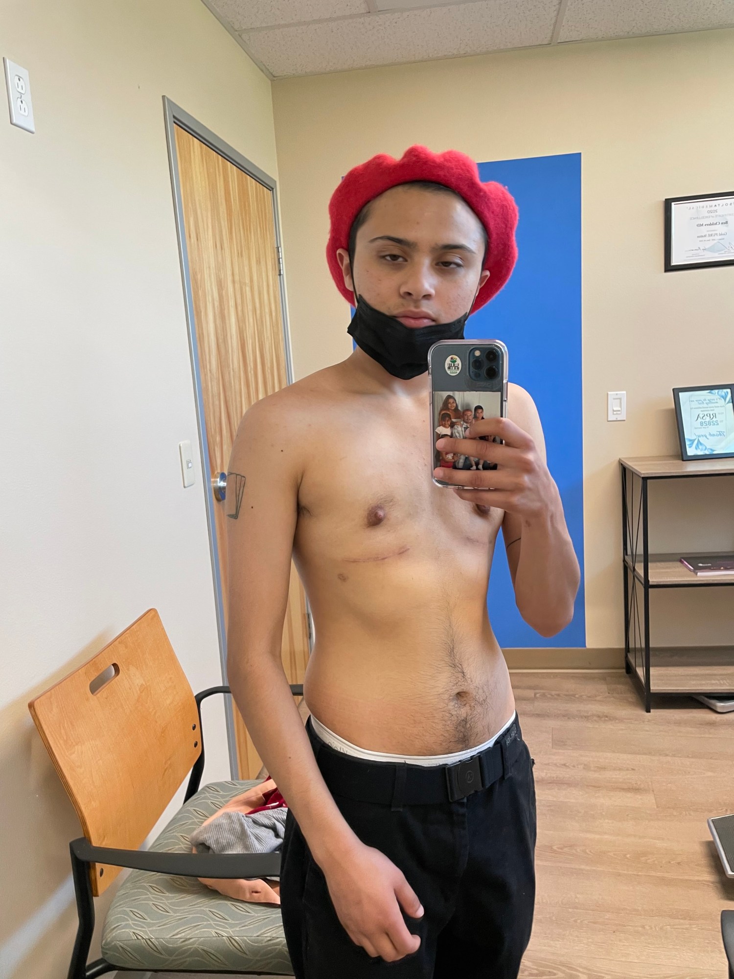 a trans man admiring his shirtless body post top surgery with a mirror selfie in his doctor's office