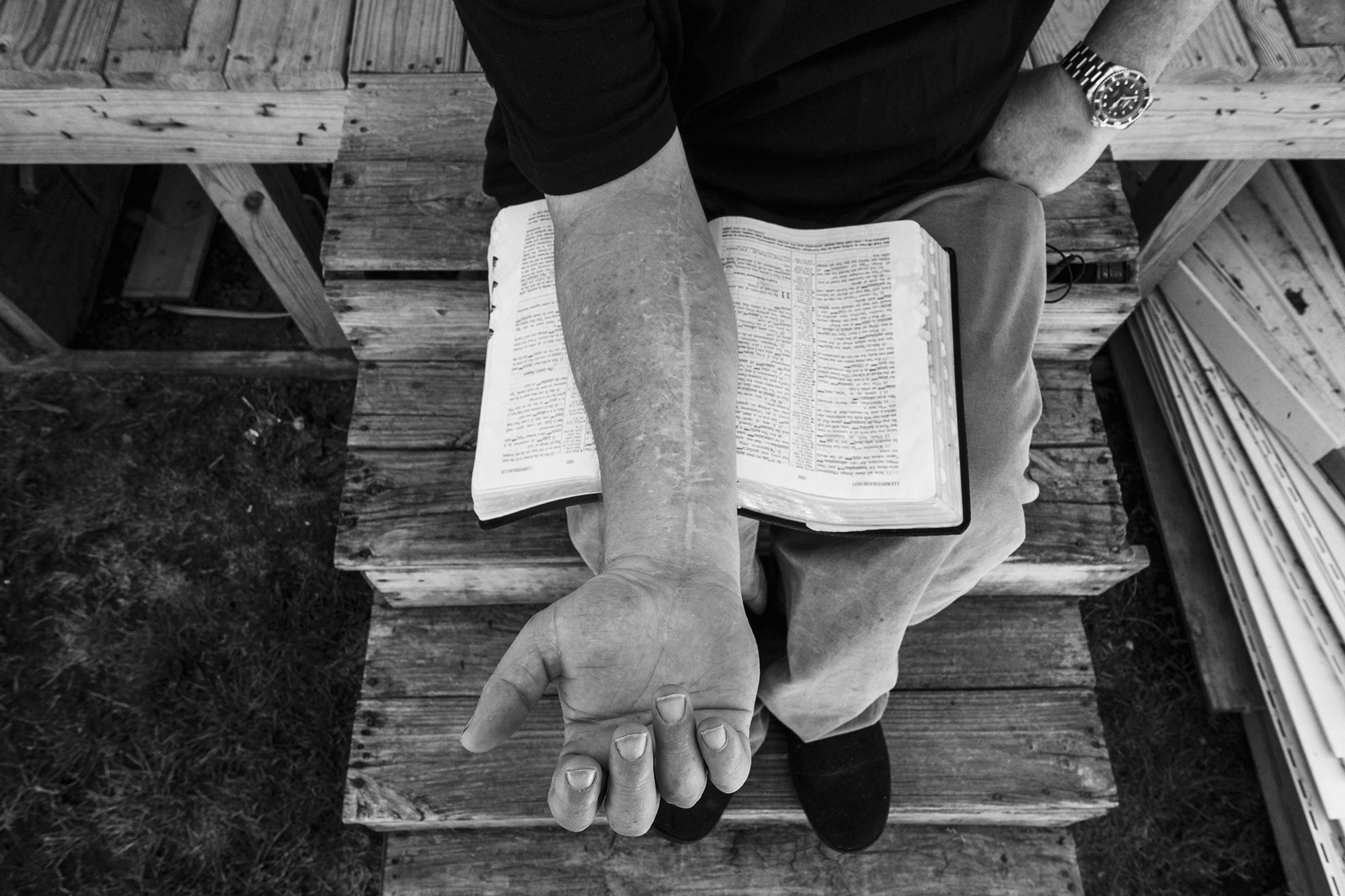 a man with a scar up his right arm, held over a bible