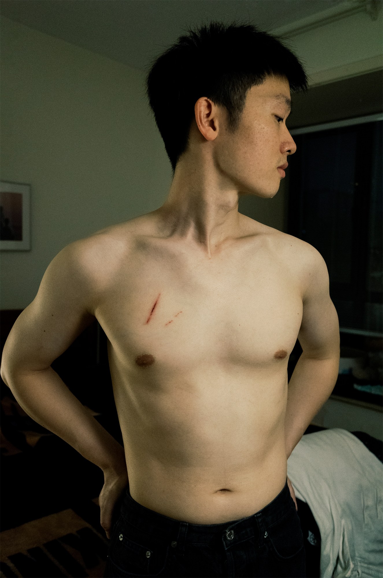 photo of a shirtless man with a cut on his chest looking away from the camera.