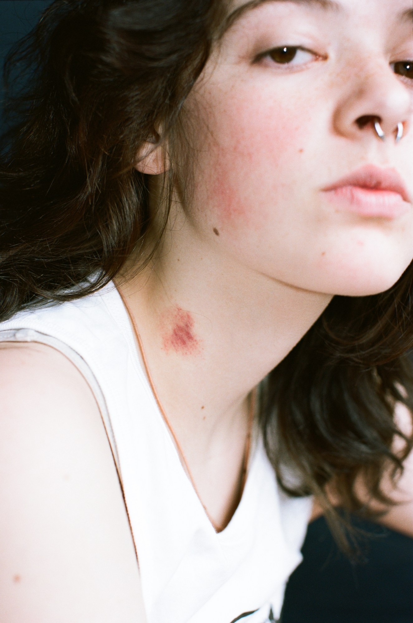 a person with long dark hair looks into the camera, they have a love bite on their neck