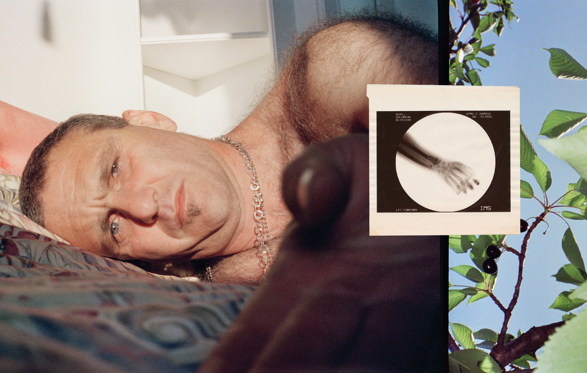 a man lying on his side, with a polaroid of a broken arm x-ray collaged over the top