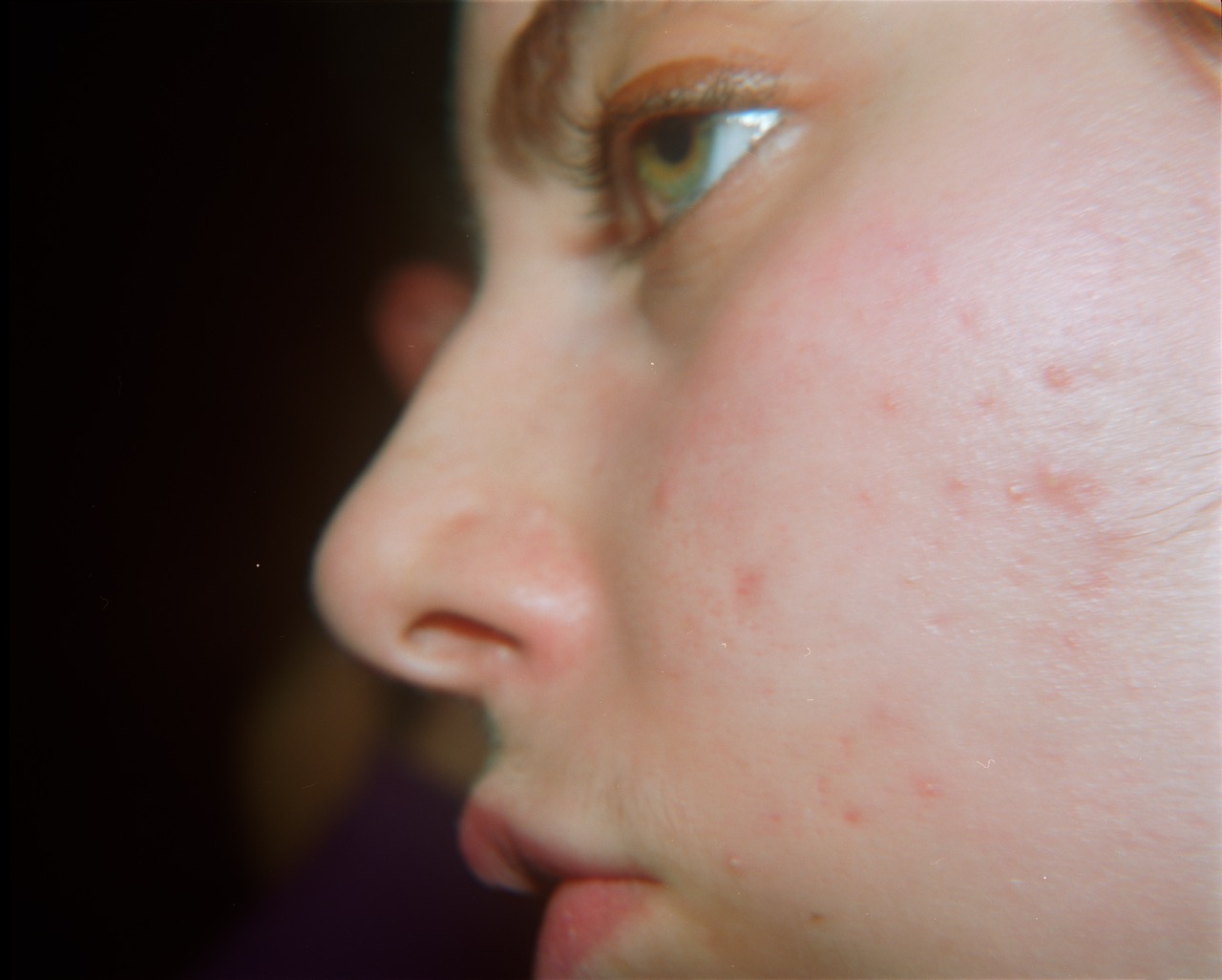 Photograph by Nick Waplington of a close up of someone's face taken on a London dance floor in 1996 from The Safety in Numbers series